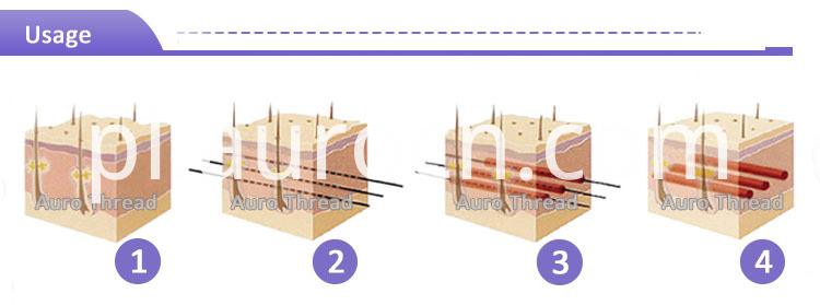Podnośnik do oczu Pdo wątku Pdo Thread Eye Lift